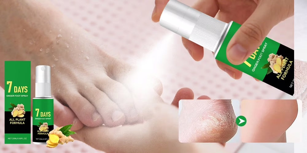 Kovettumia poistava jalkasuihke