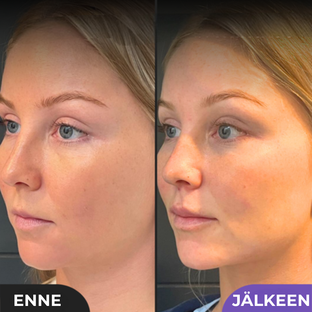 Ammattimainen Kauneudenmuotoilija