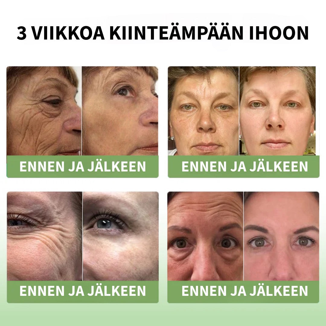 Kollageenivoide