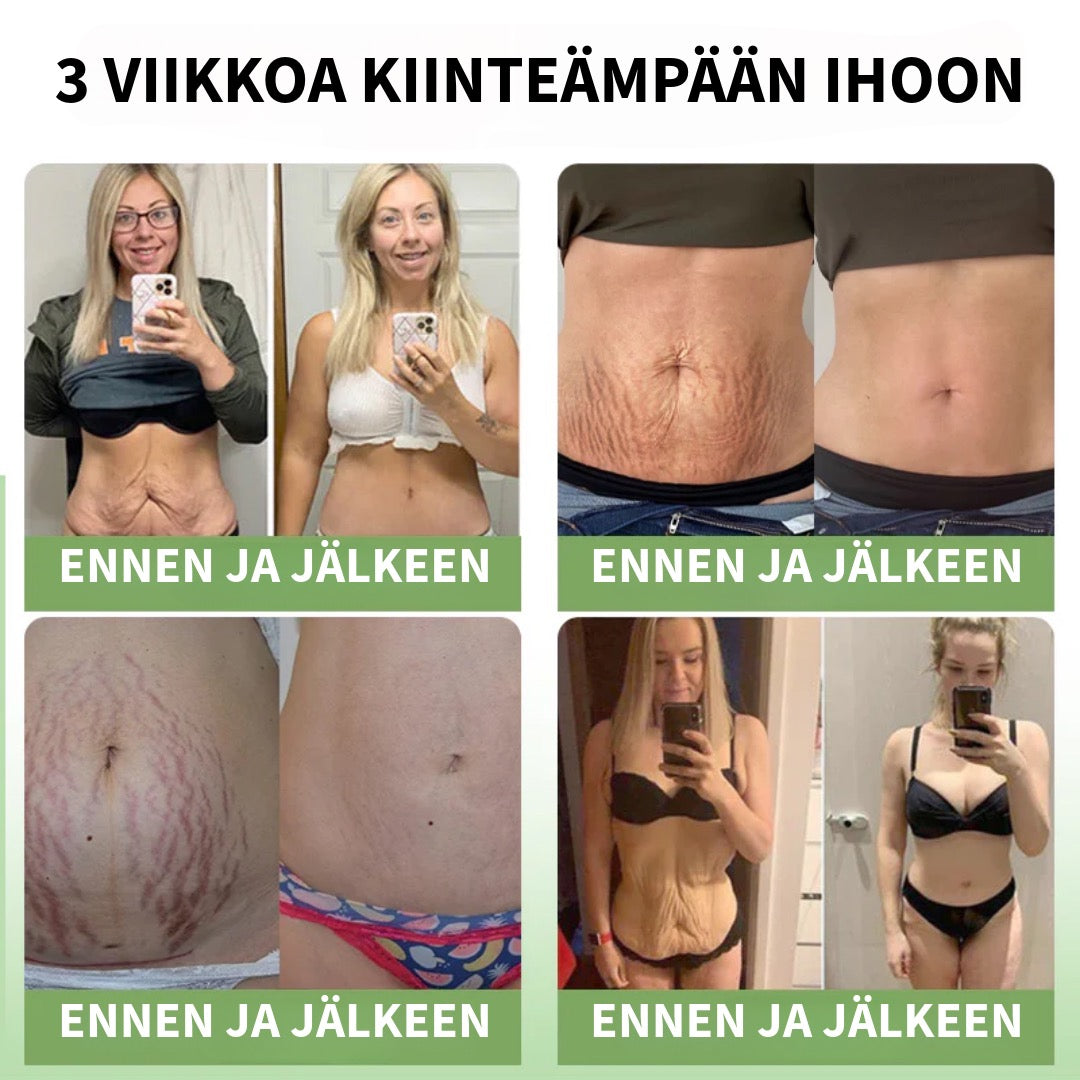 Kollageenivoide