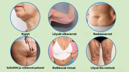 Kollageenivoide