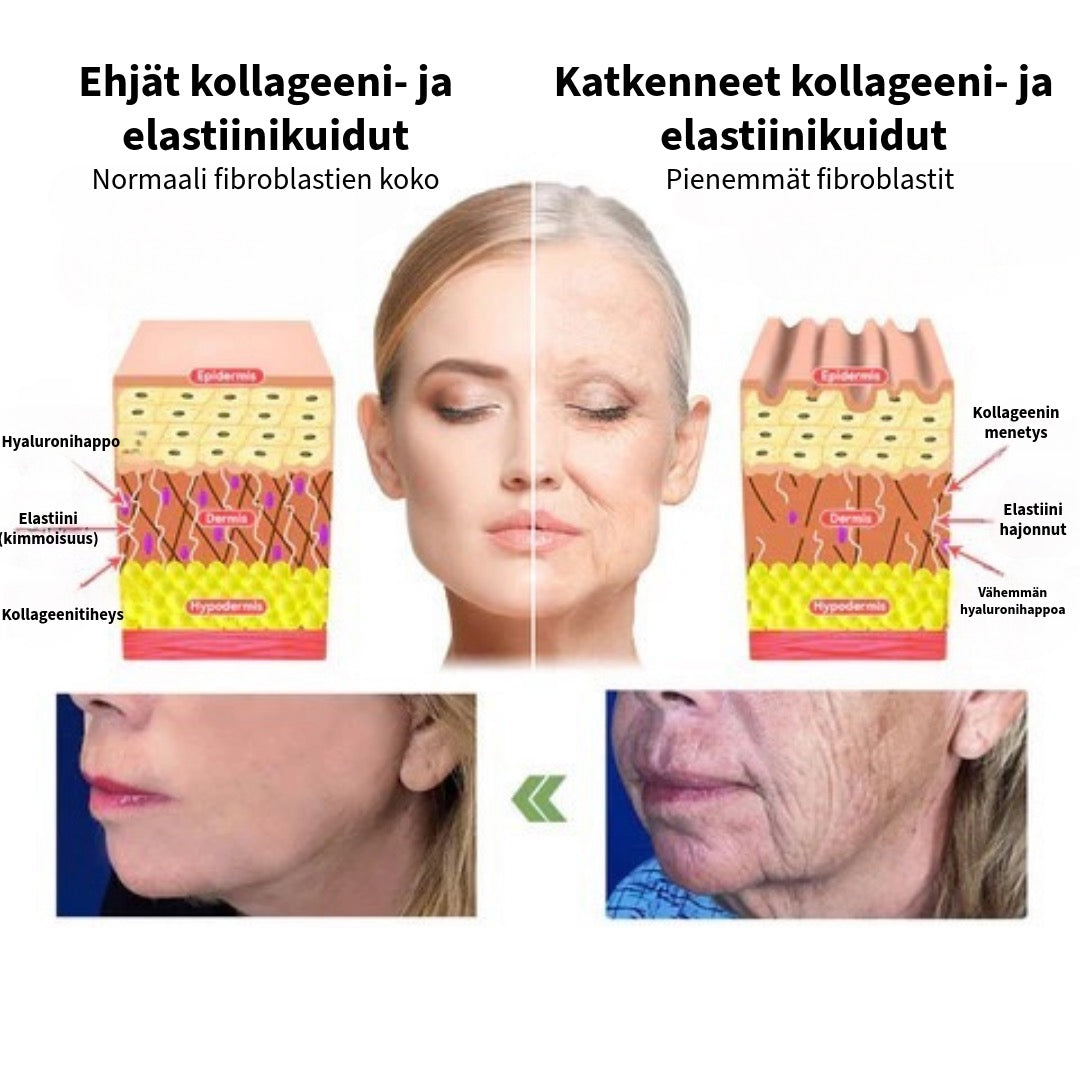 Kollageenivoide